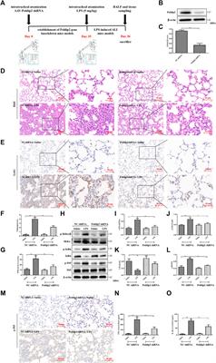 Poldip2 knockdown protects against lipopolysaccharide-induced acute lung injury via Nox4/Nrf2/NF-κB signaling pathway